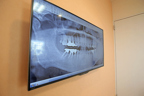 2.デンタルレントゲンによる診査