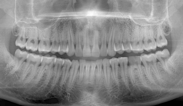 レントゲン、セファログラムの写真（デジタルデータ） イメージ3