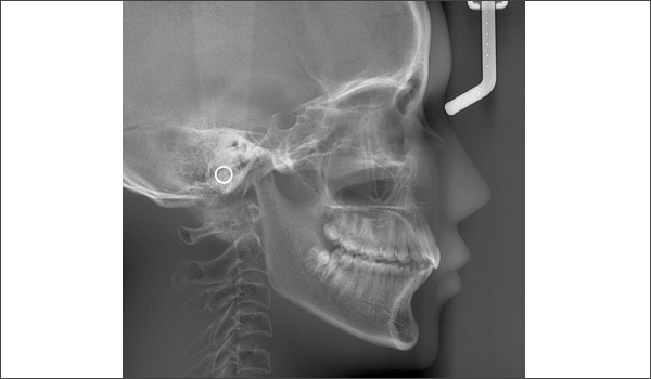 レントゲン、セファログラムの写真（デジタルデータ） イメージ4