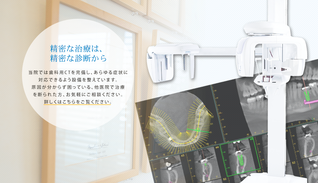 精密な治療は、精密な診断から 当院では歯科用CTを完備し、あらゆる症状に対応できるよう設備を整えています。原因が分からず困っている、他医院で治療を断られた方、お気軽にご相談ください。詳しくはこちらをご覧ください。